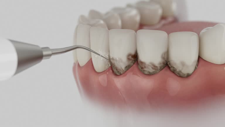 Trusted Emergency Dentist service in Brooklyn Heights, OH - Dentist Open Now